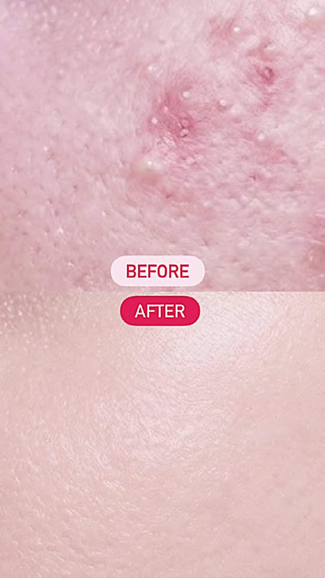 @Dermacrush