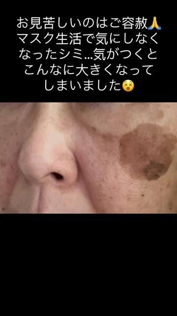 @ケムまる🍎🧄🍮