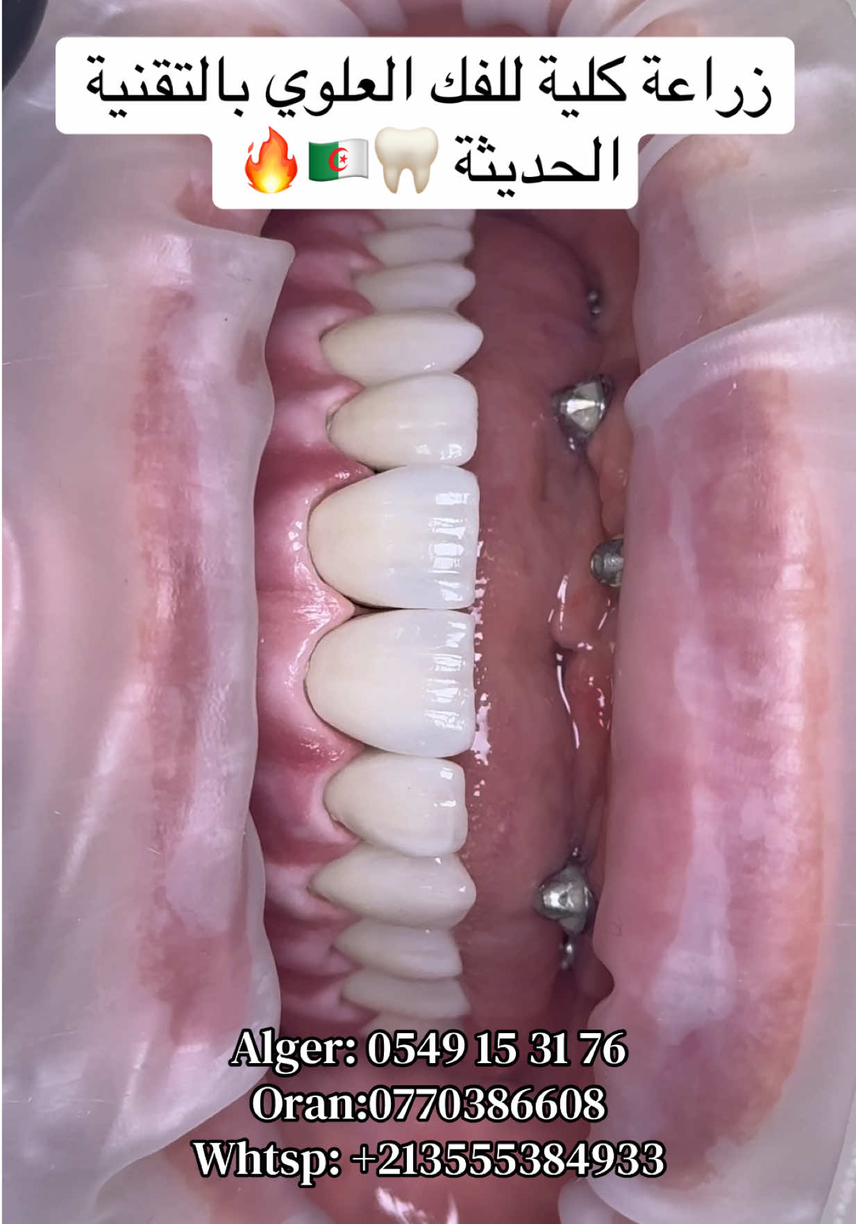 @Dr.ladjali