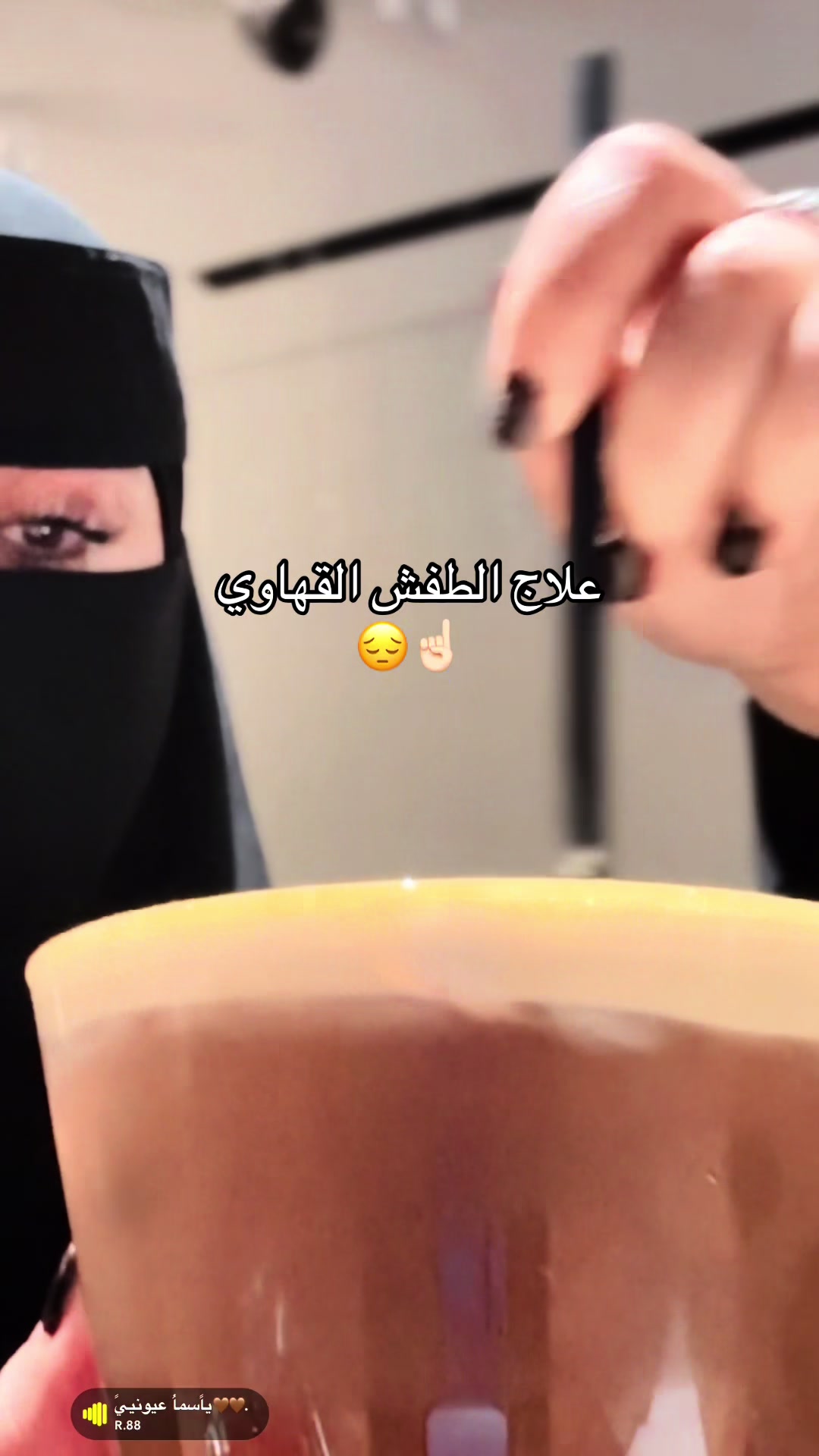 @سوير 🤳✨