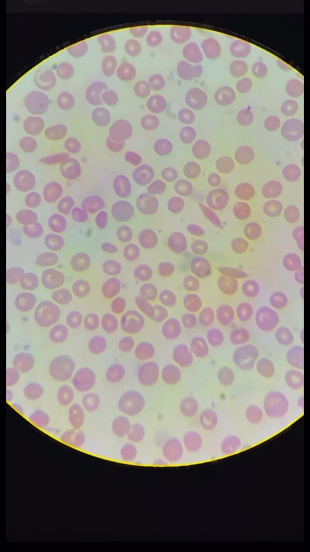 @ALab 🔬💉🩸