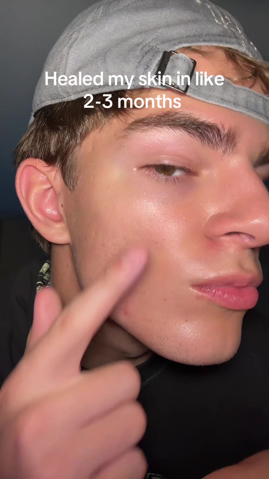 @Finn
