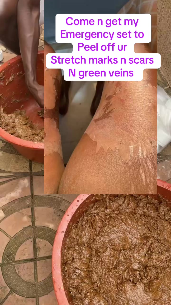 @@ Precious peeling soap