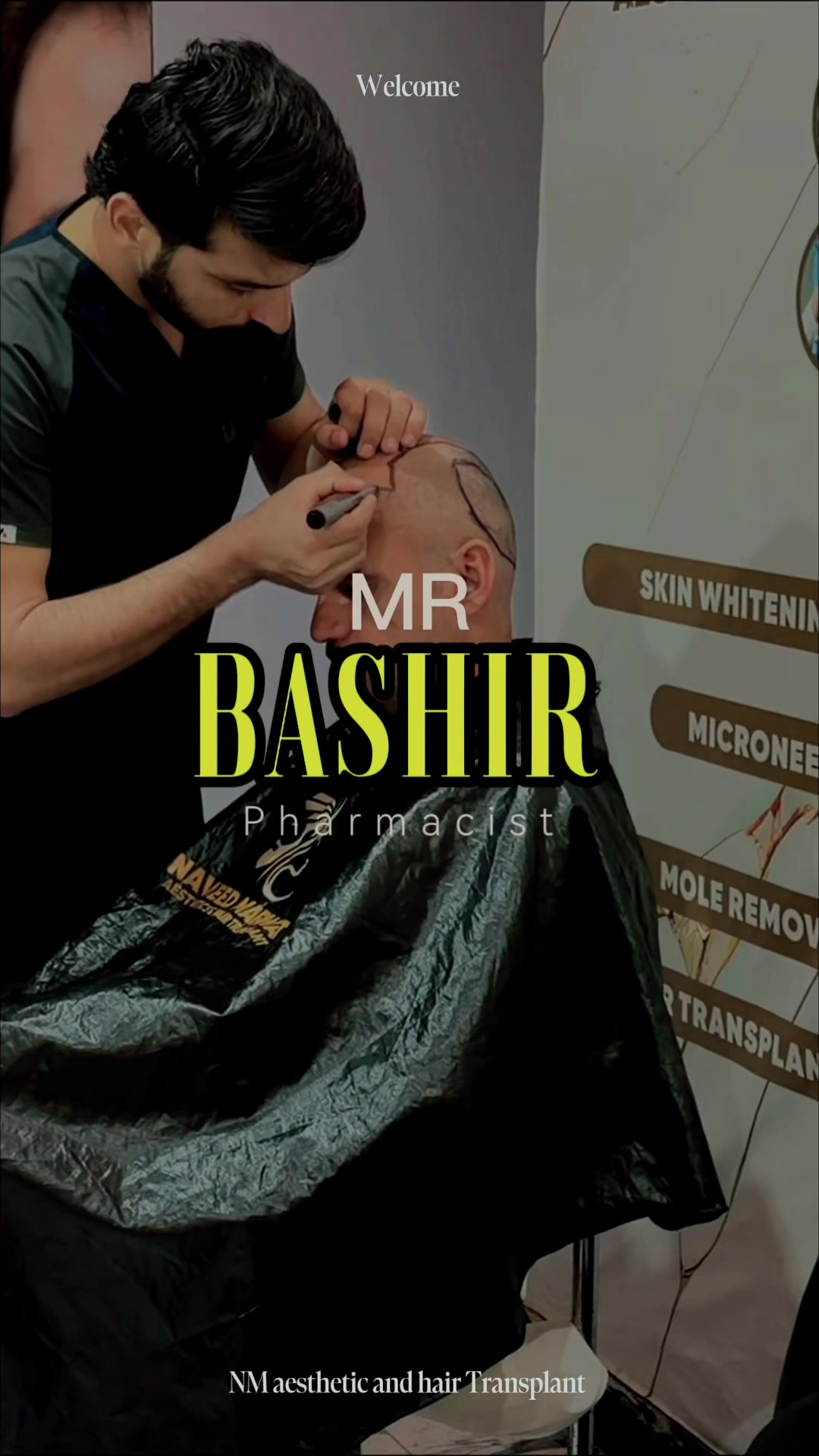 @Naveed Marwat HairTrnsplant
