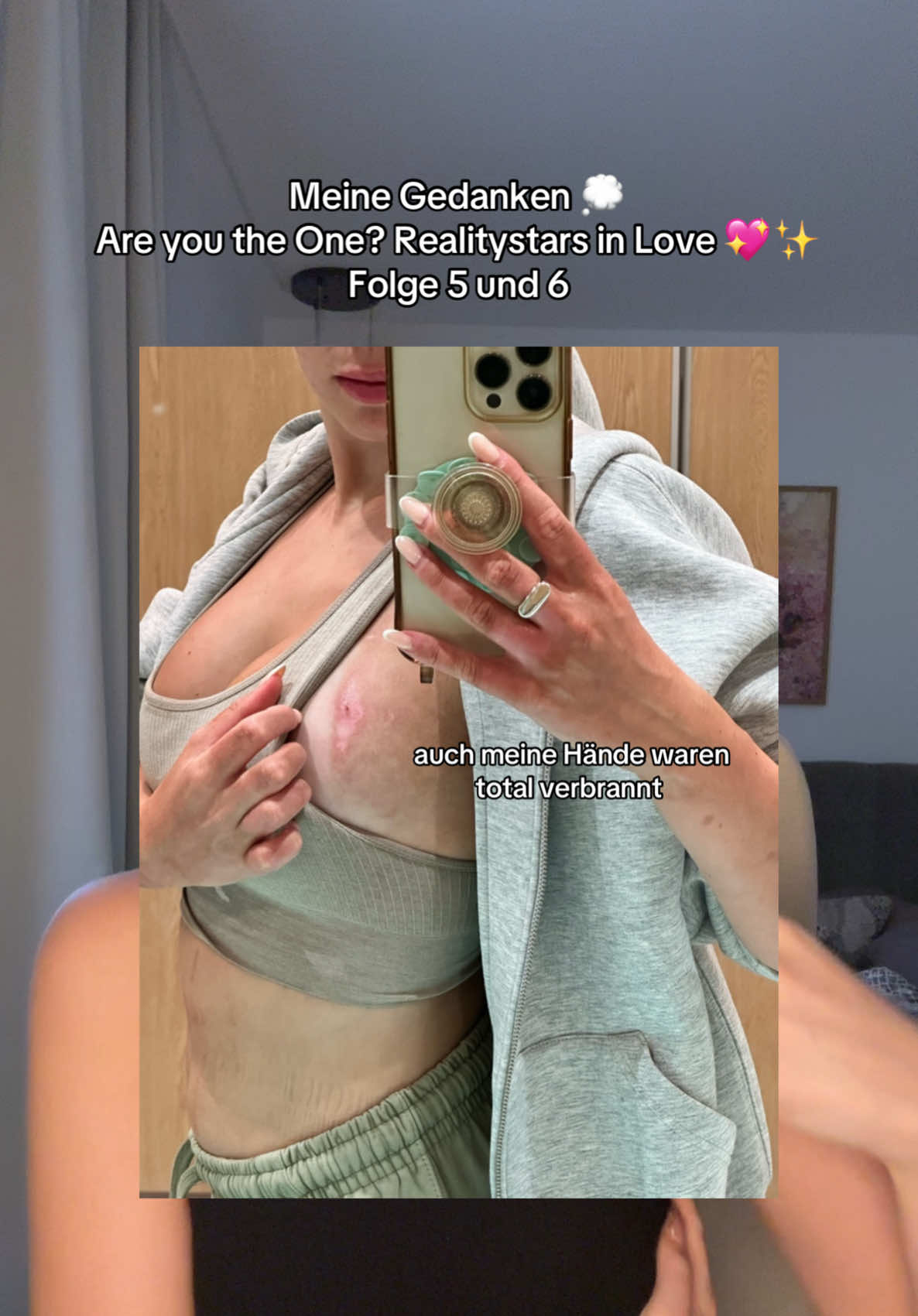 @Alexandra | AYTO RSIL 6 💖✨