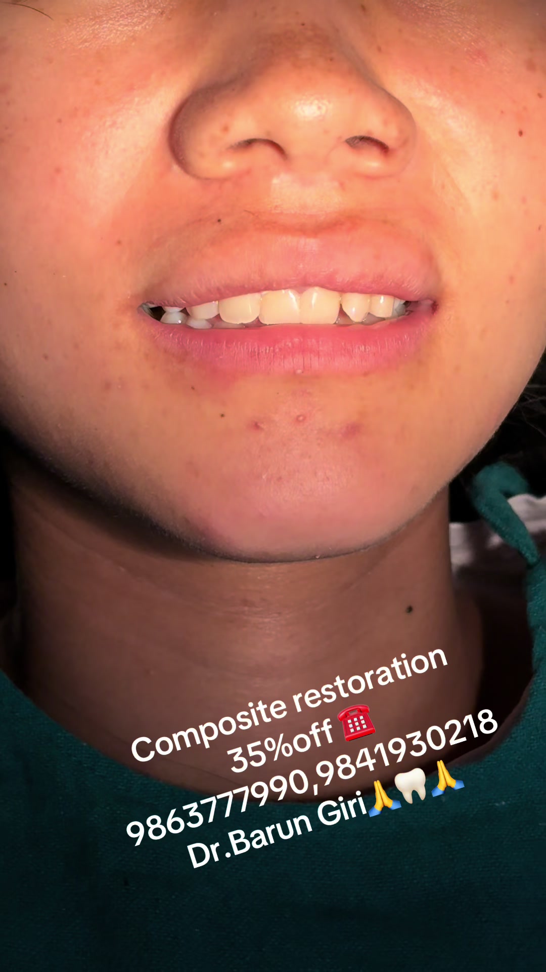 @Unique dental clinic Chabahil