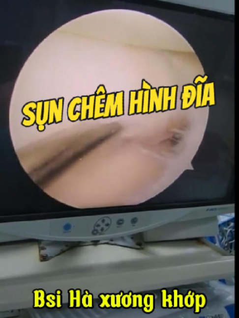 @Chuyên gia xương khớp