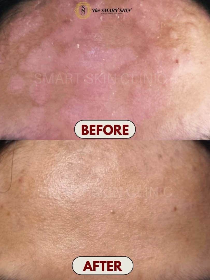 @The Smart Skin- Malolos