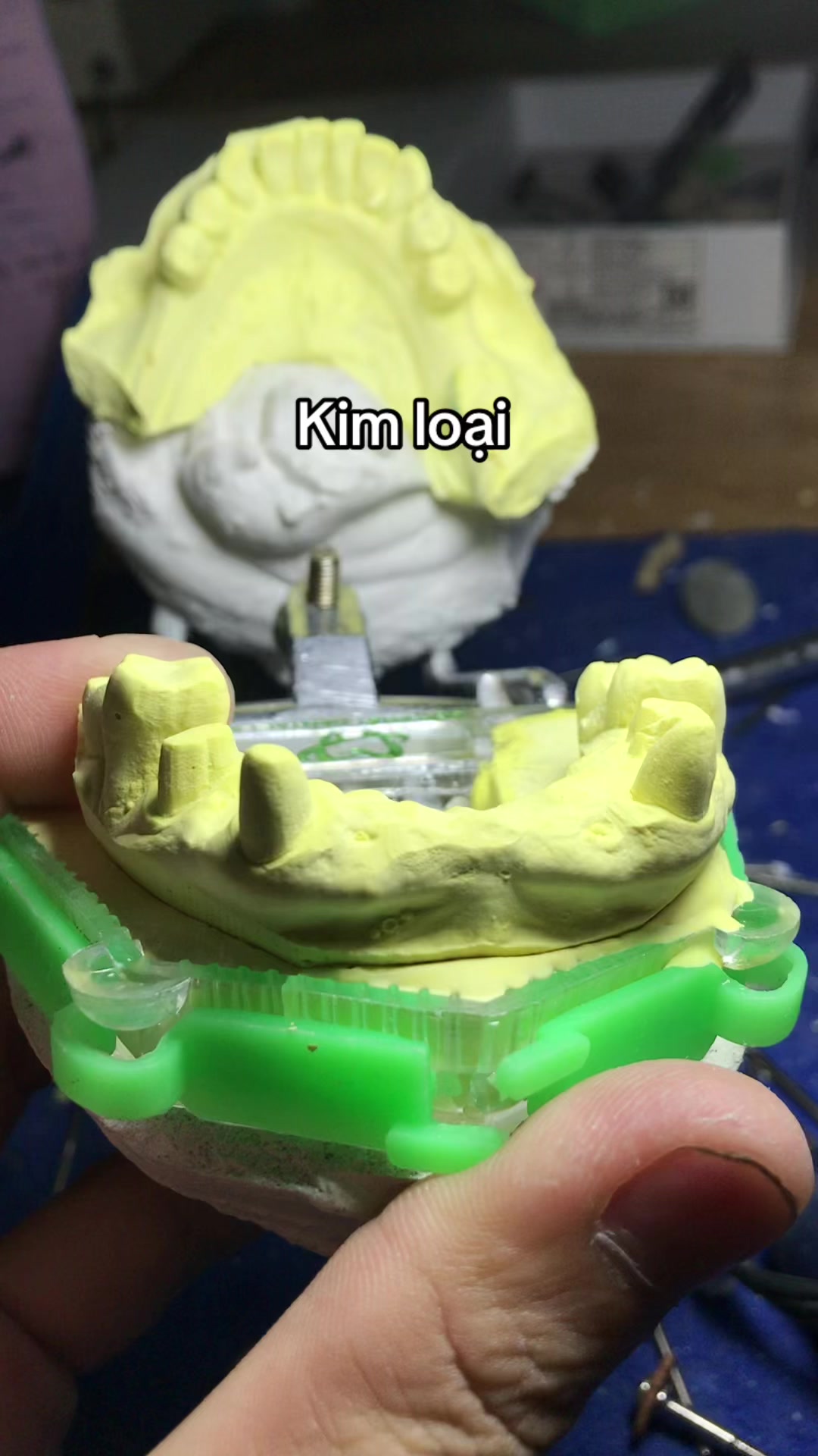 @Hùng răng sứ 🦷🦷