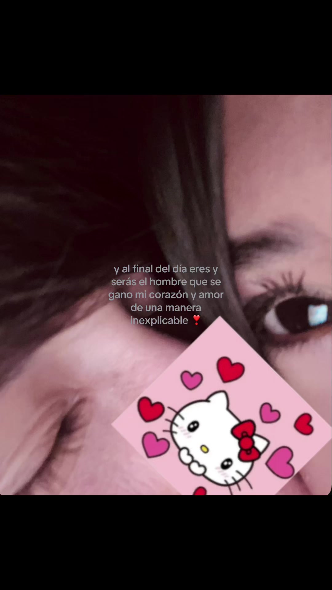 @𝑀𝑒𝓁𝒶𝓃𝓎.🍒