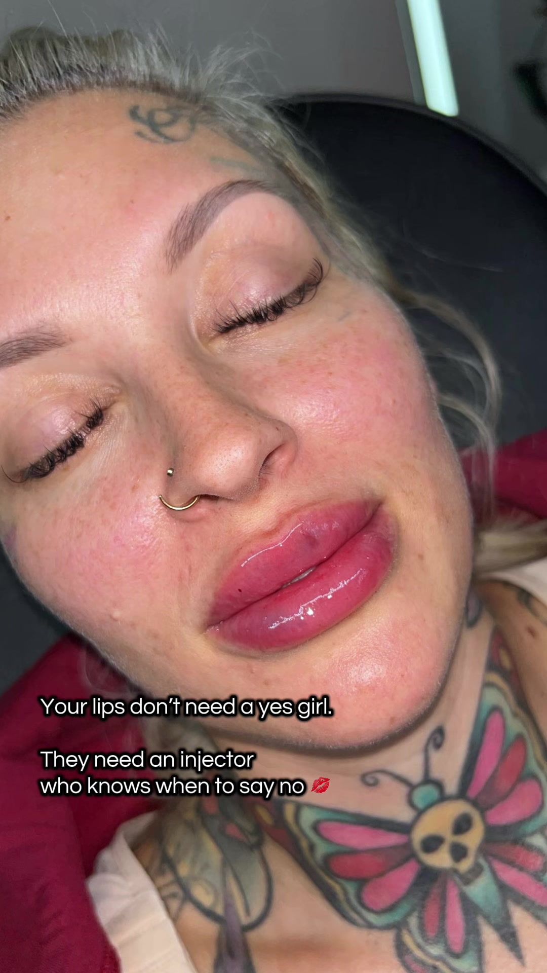 @injectormami