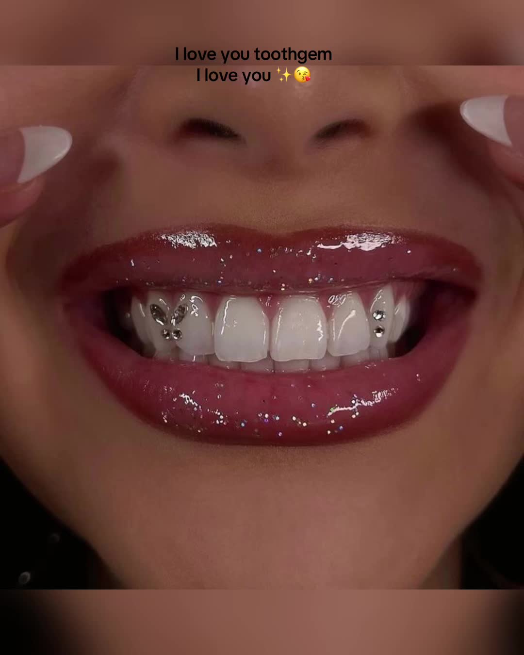 @🚩