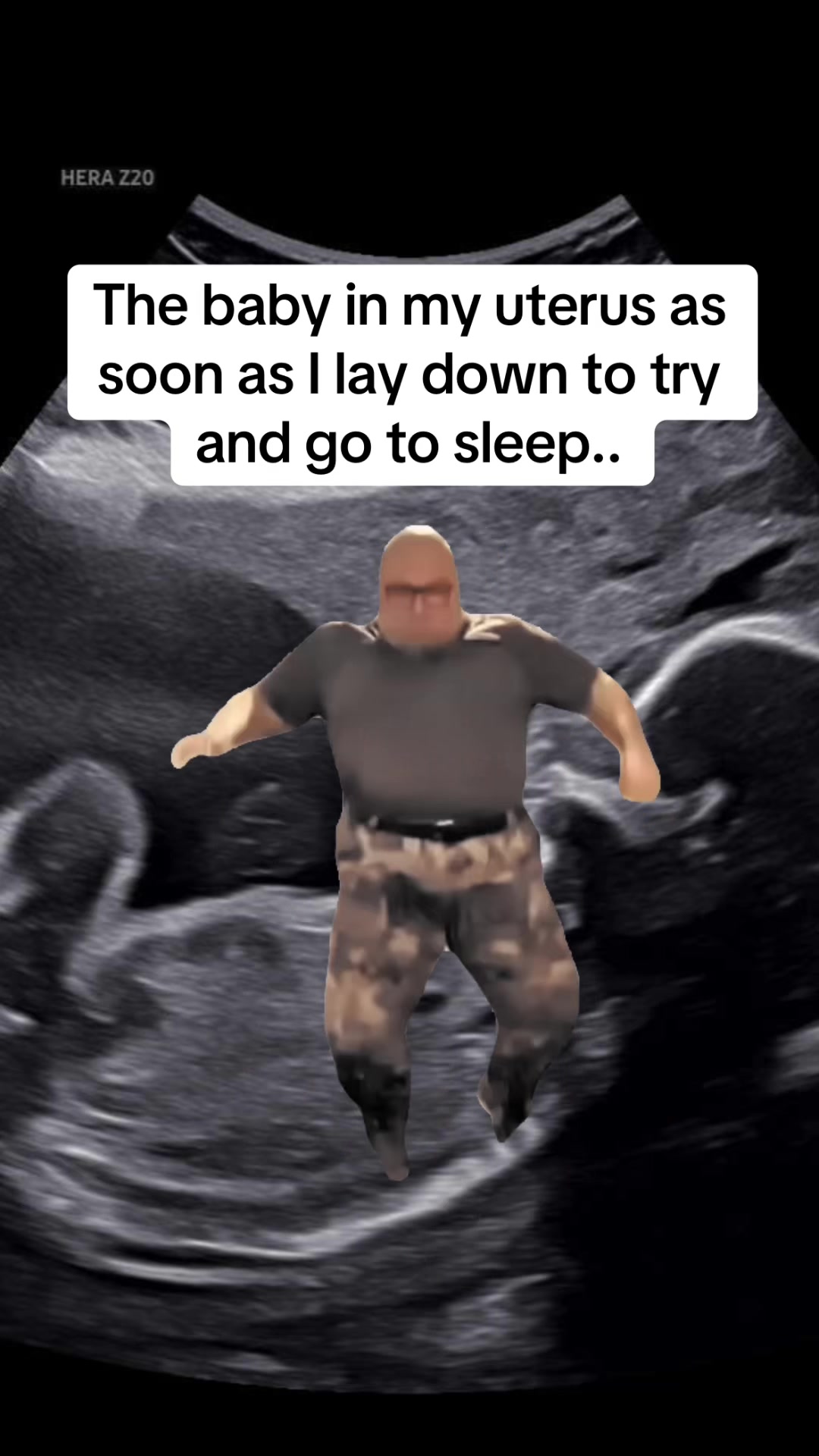 @kalico386