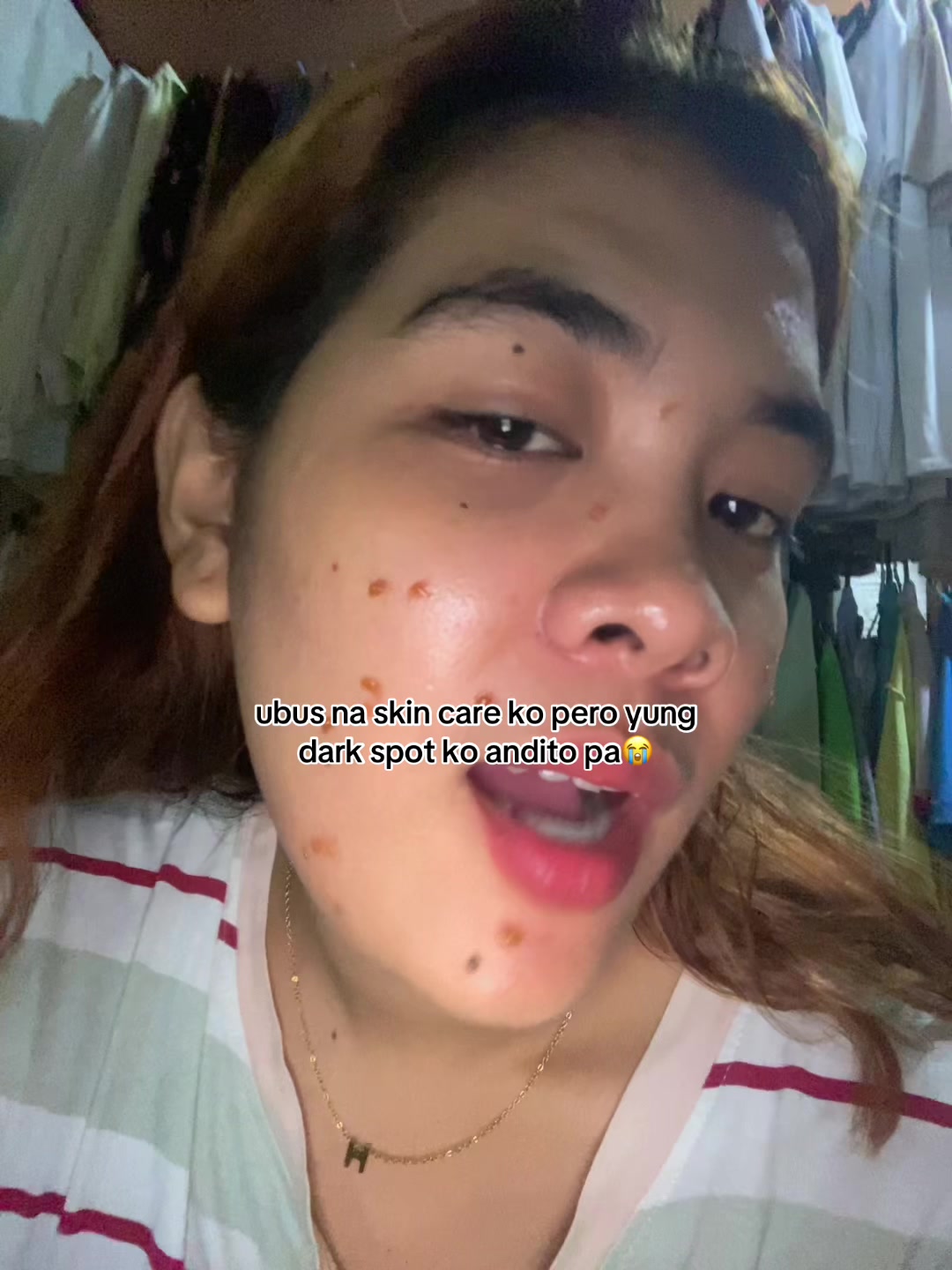 @hae