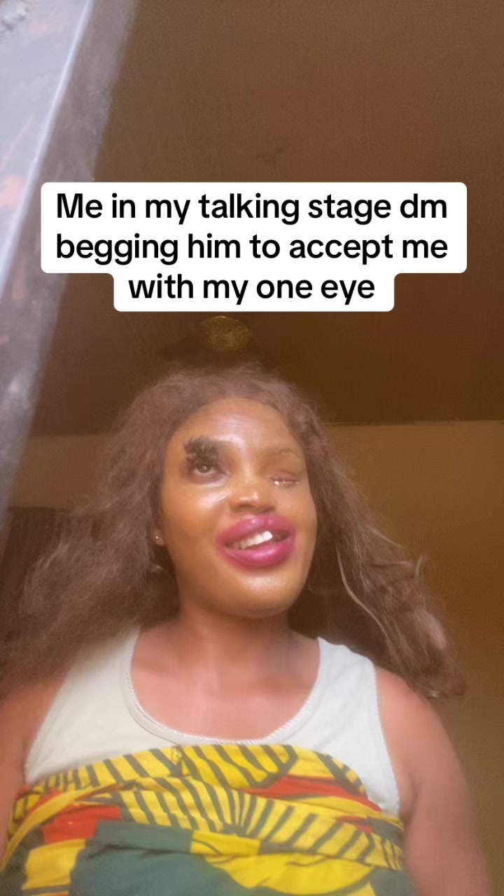 @OMA