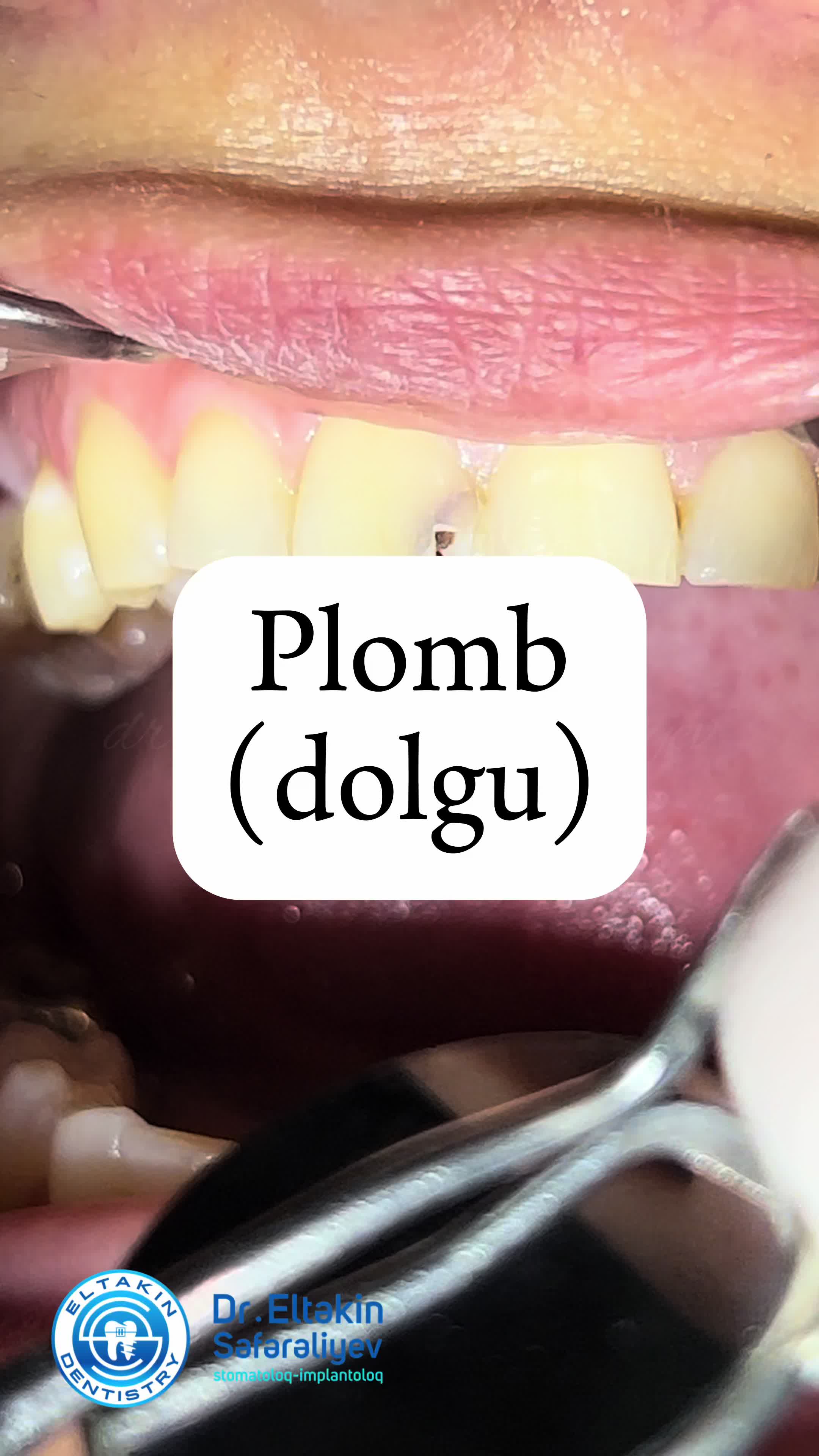 @eltakindentistry