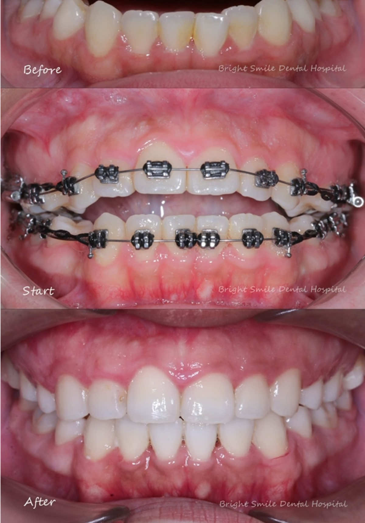 @BRIGHT SMILE DENTAL HOSPITAL