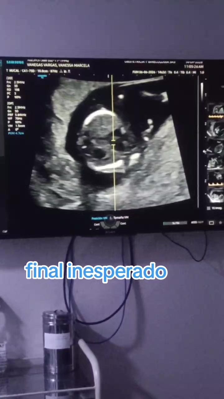 @Jaime_kevin4