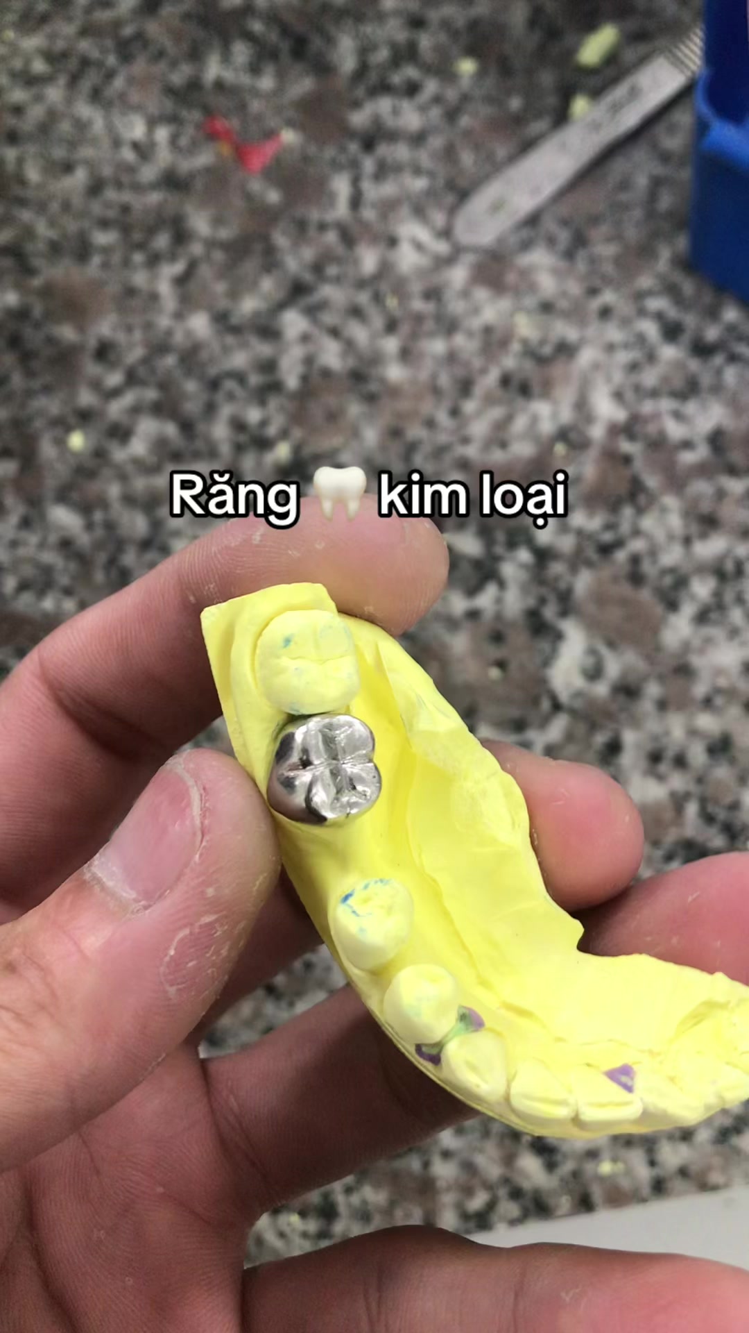 @Hùng răng sứ 🦷🦷