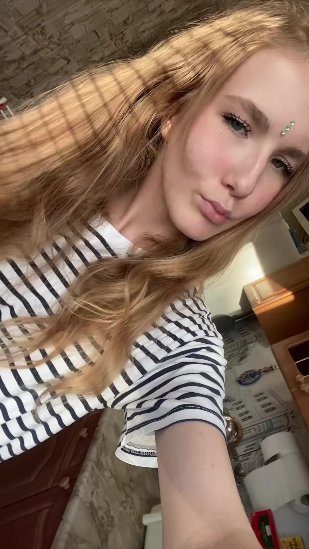 @scarred_arms