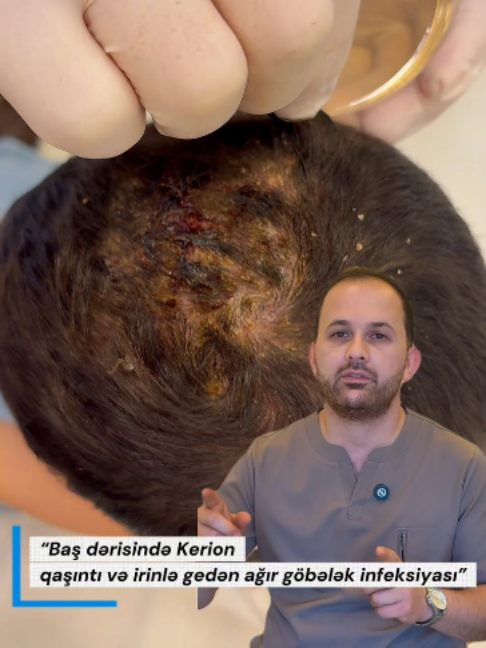 @Dr.Eldar Məmmədov