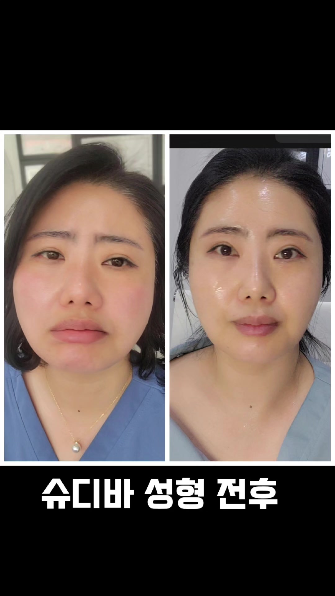 @피부굿당 박보살의 피부로 인생역전!