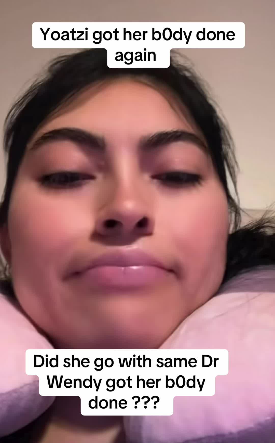 @chismocitos1