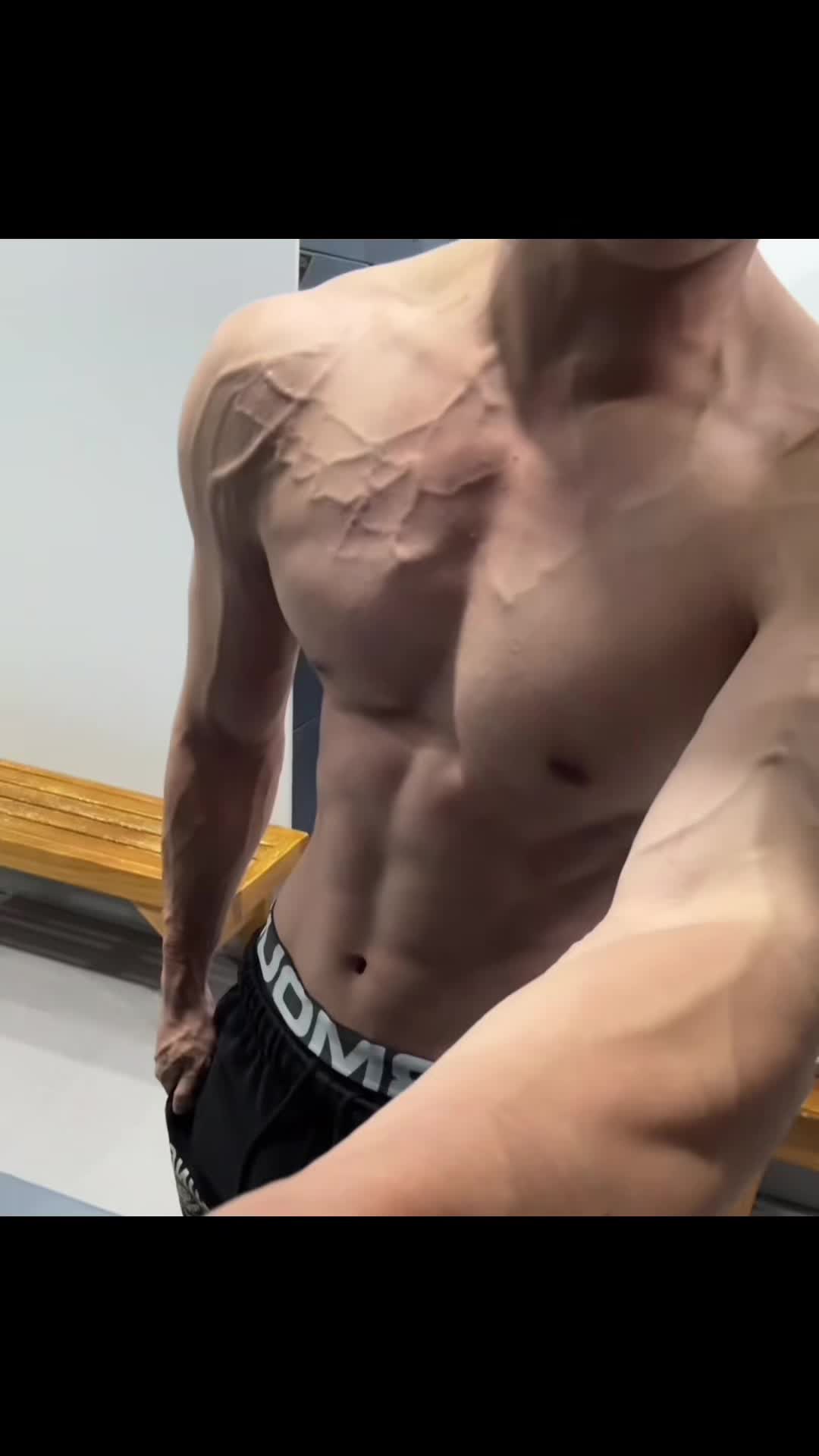 @VINTRX