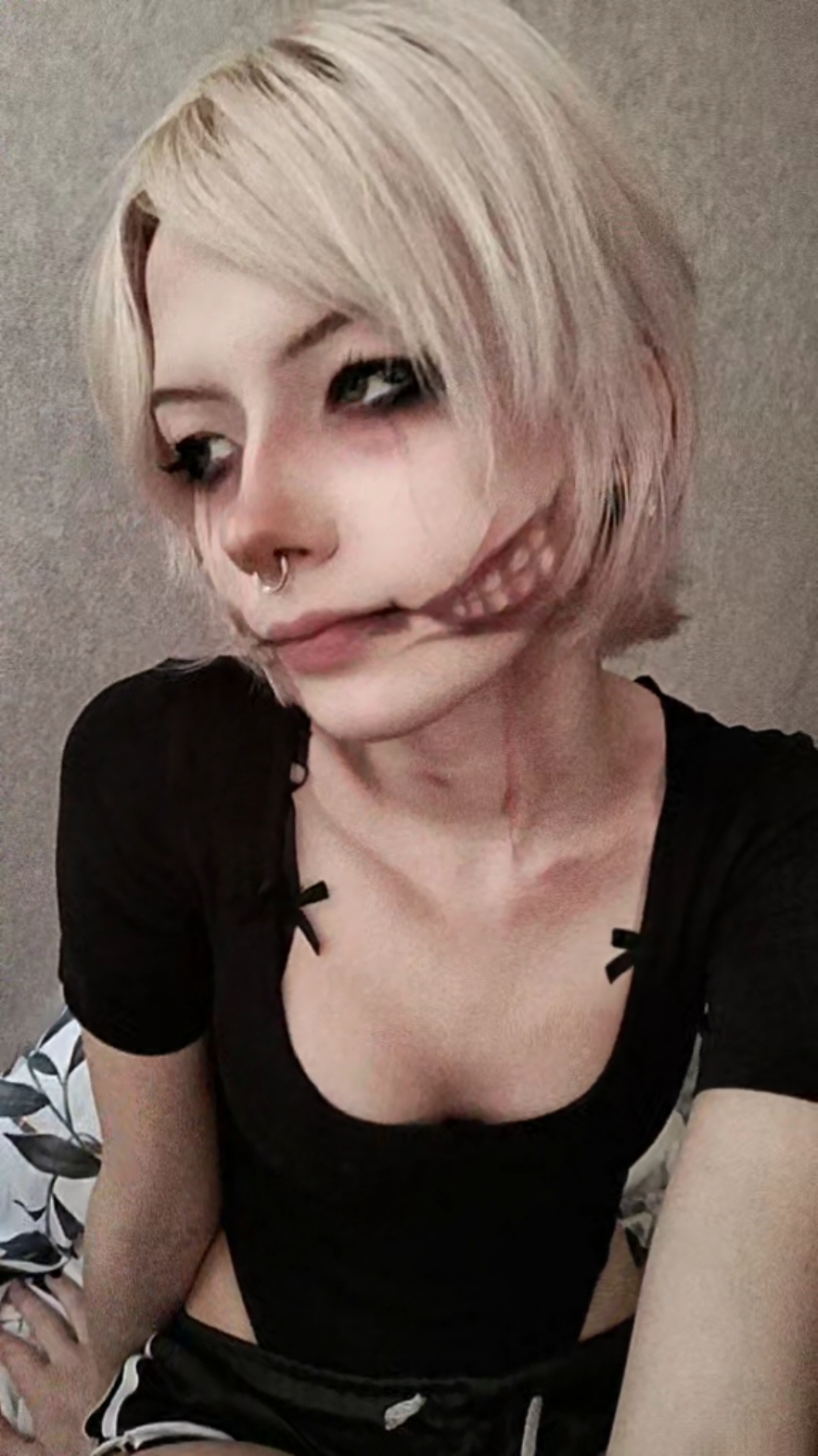 @лиска паралич