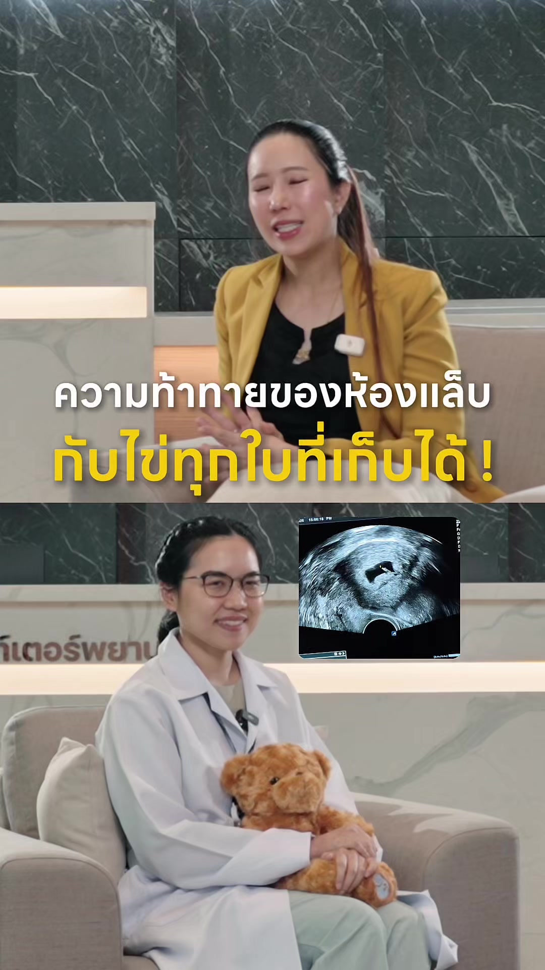 @หมอป่องสวยมาก veneer 🦷