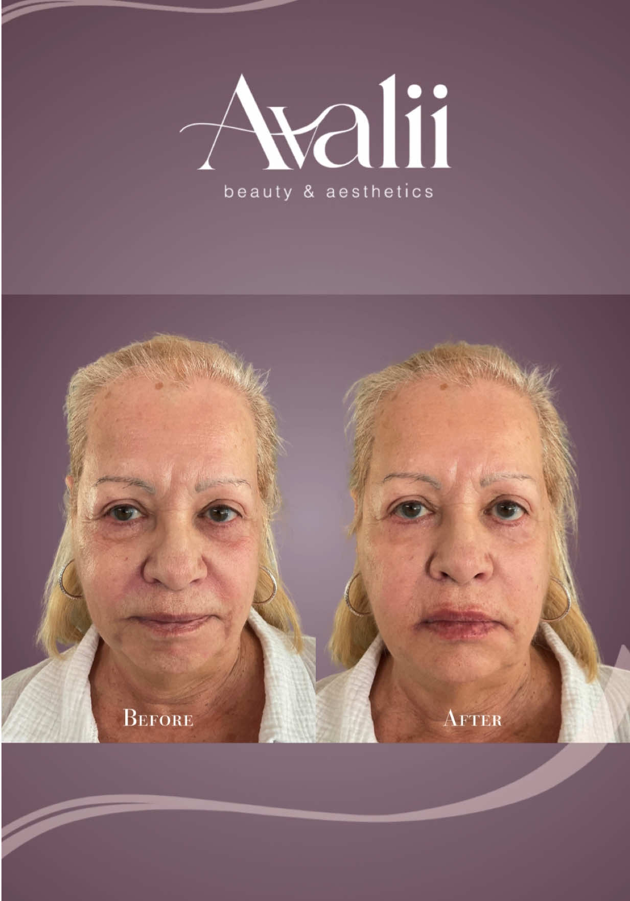 @Avalii Aesthetics