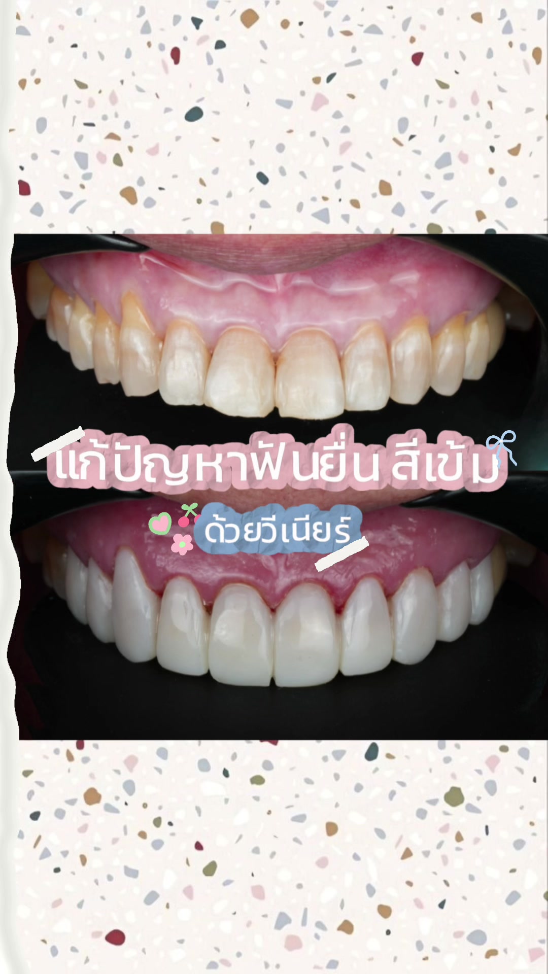 @smile Art Pattaya