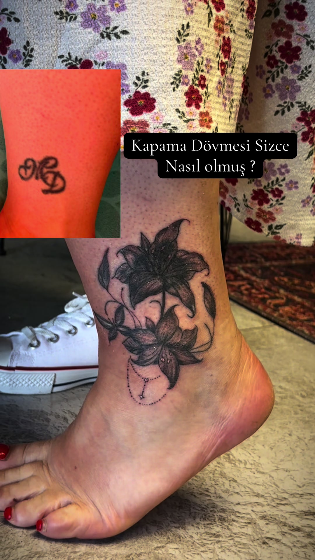 @avcilar_dovmecisi