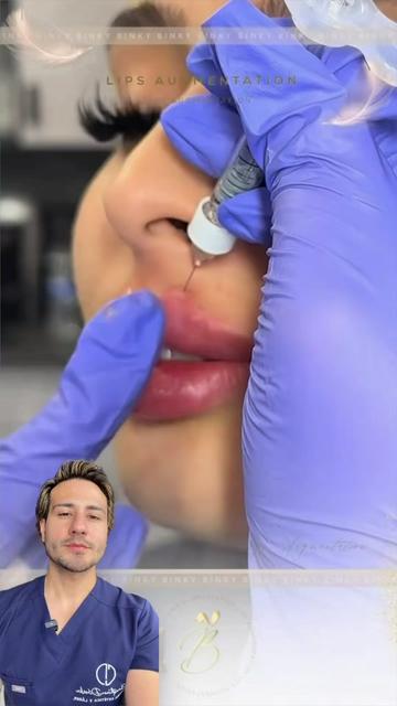 @chrisantiage