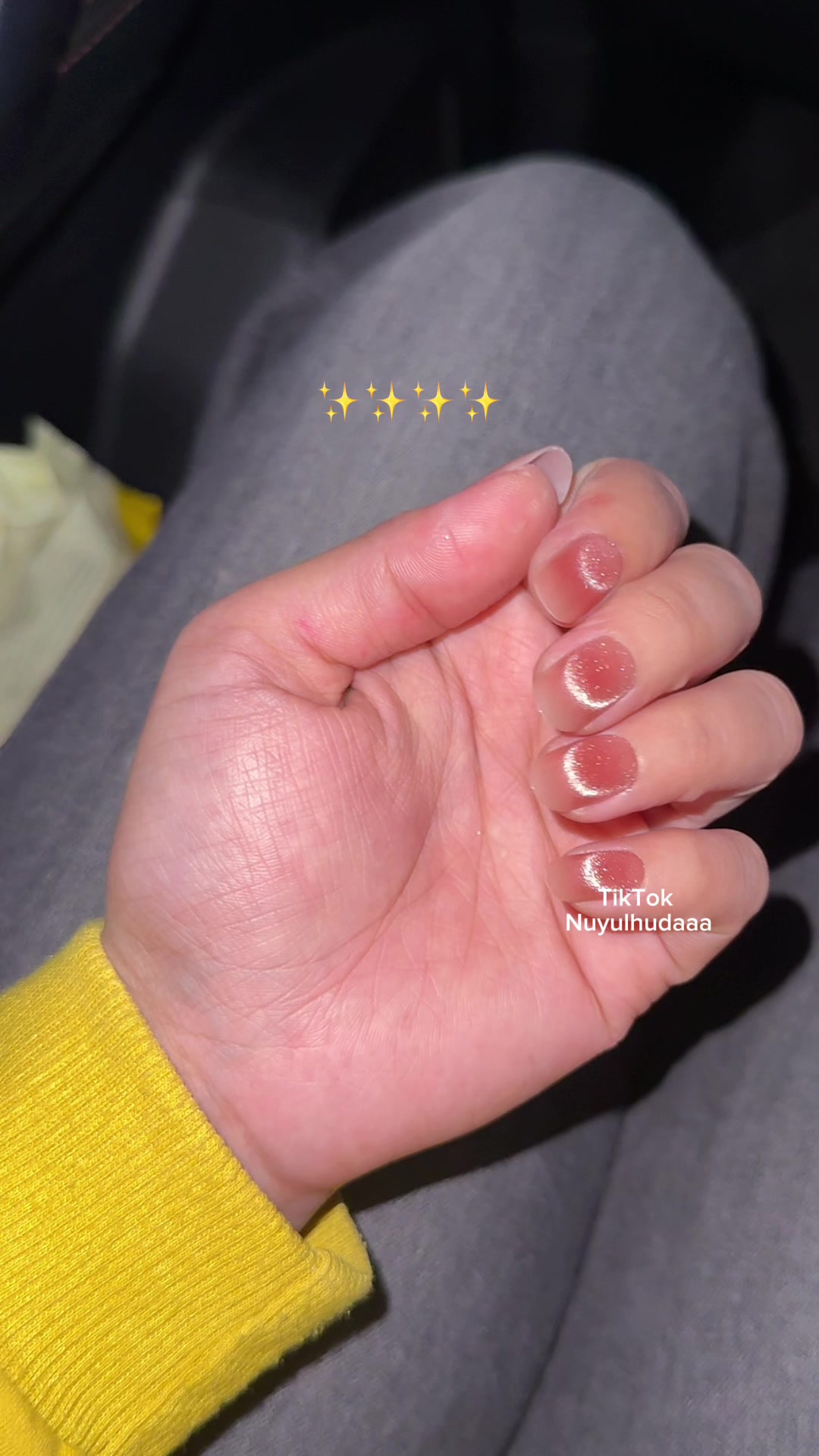 @Nuyulhudaaaa
