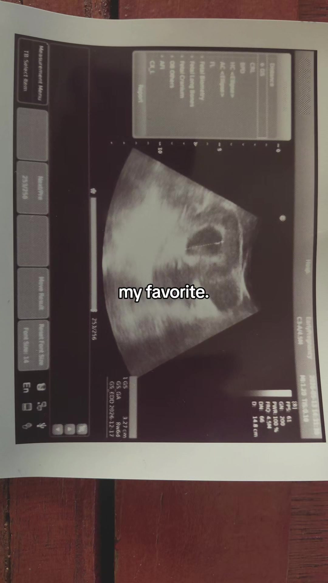 @💜👻shadow mom to be👻💜