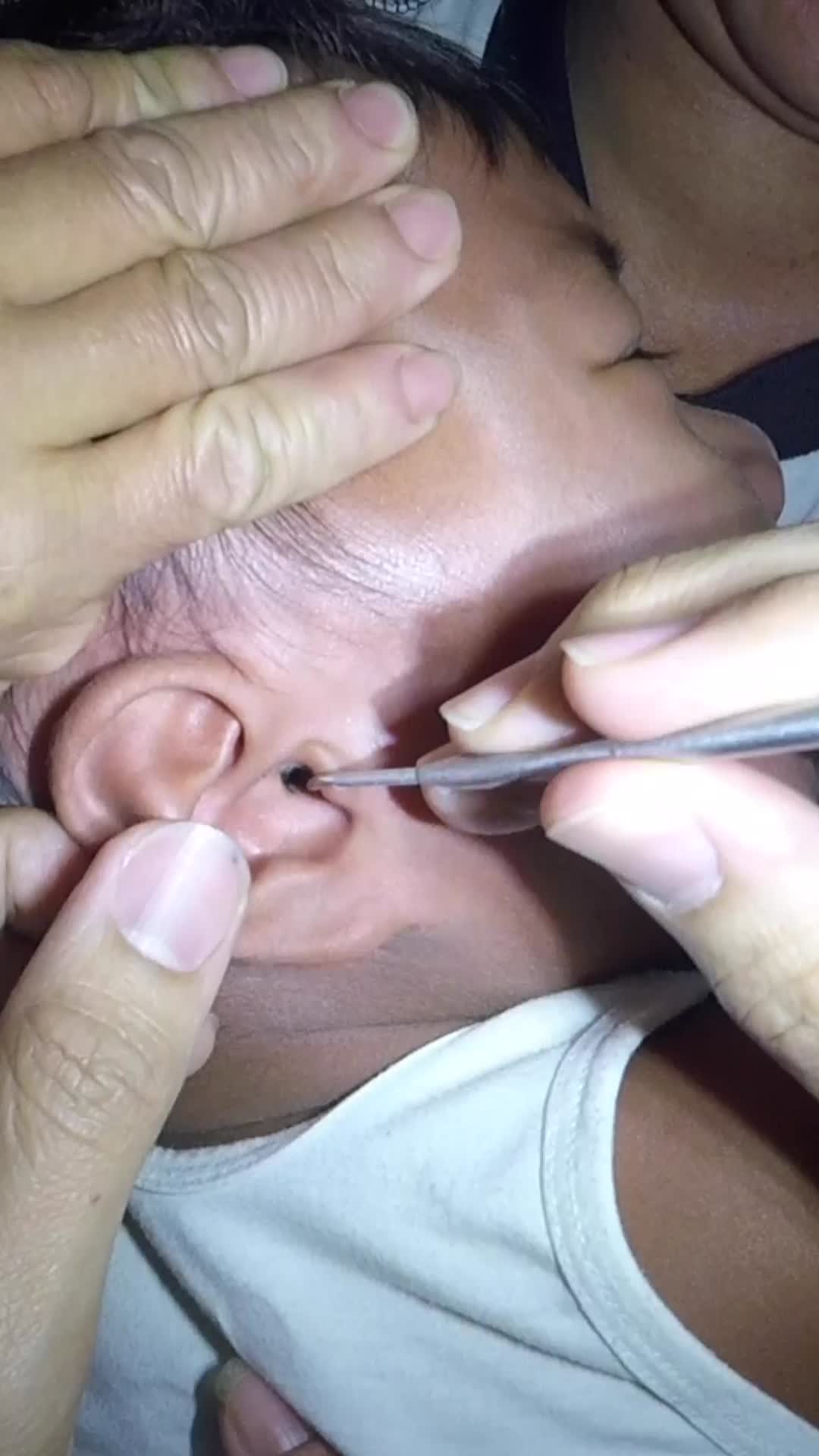@TheEarwaxSpecialist