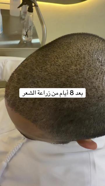 @Dr. Ahmed Alkhateeb