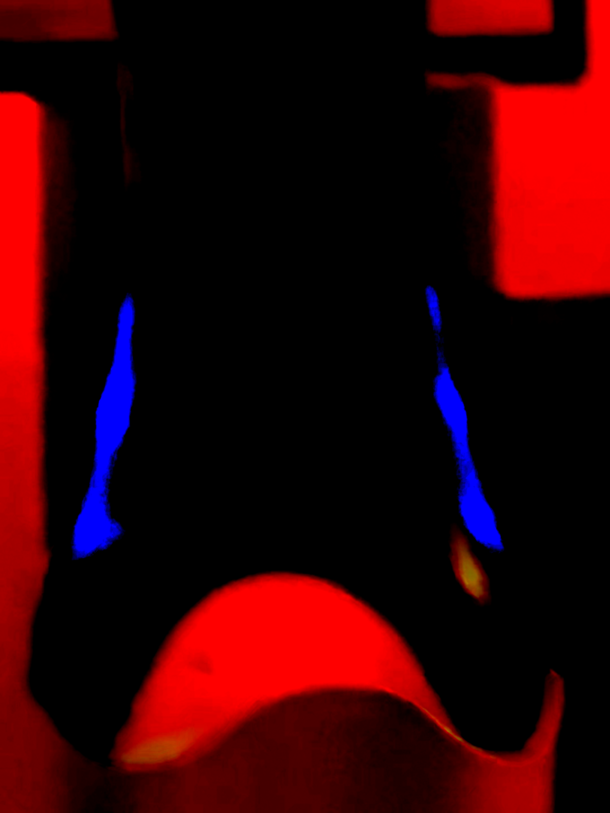@There's Still Blood Here