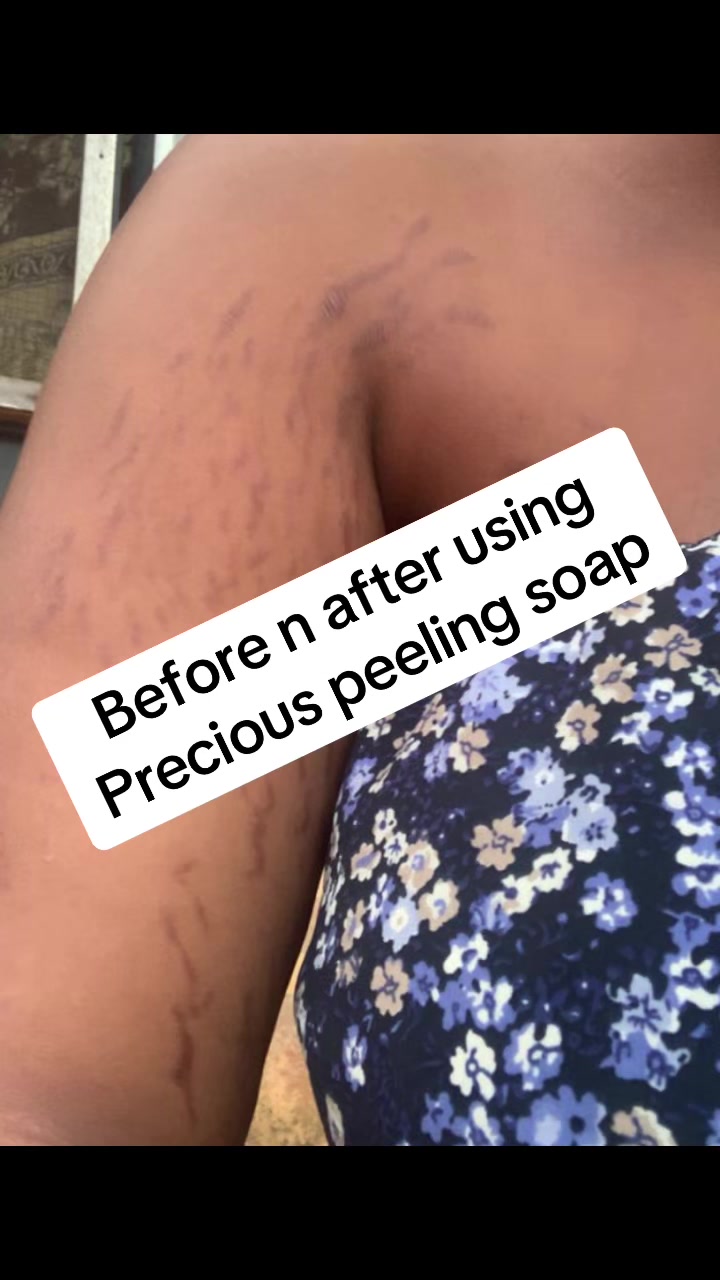 @@ Precious peeling soap