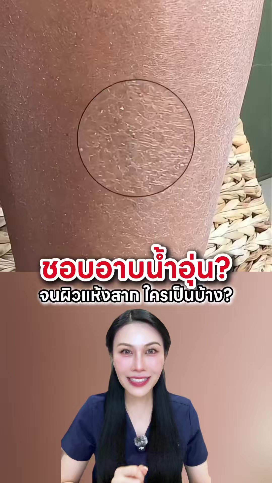 @พยาบาลอัญ