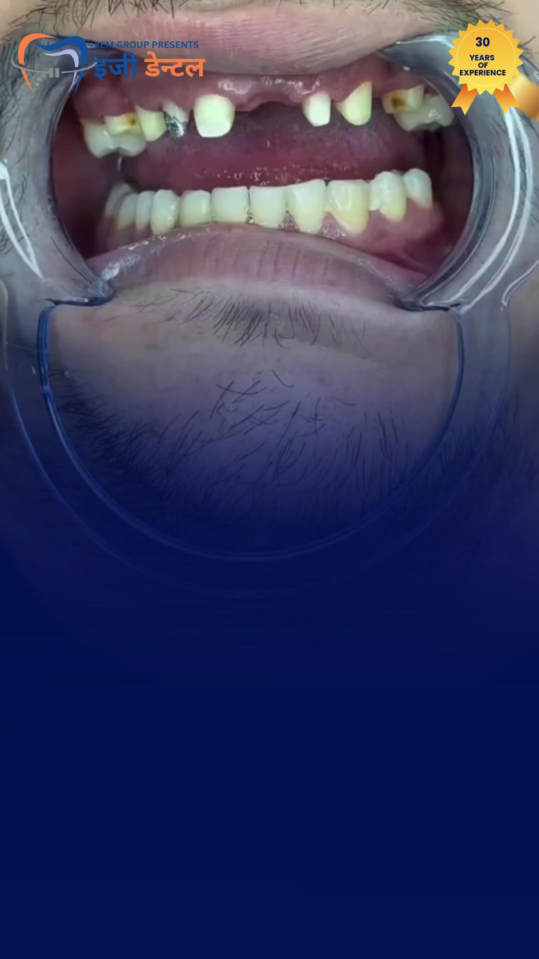 @Easy Dental