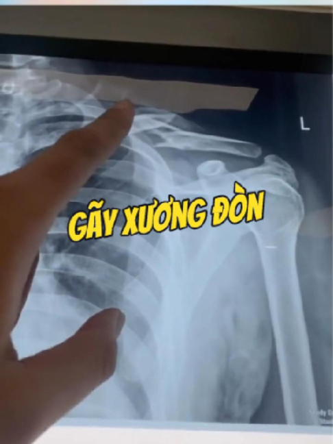 @Chuyên gia xương khớp