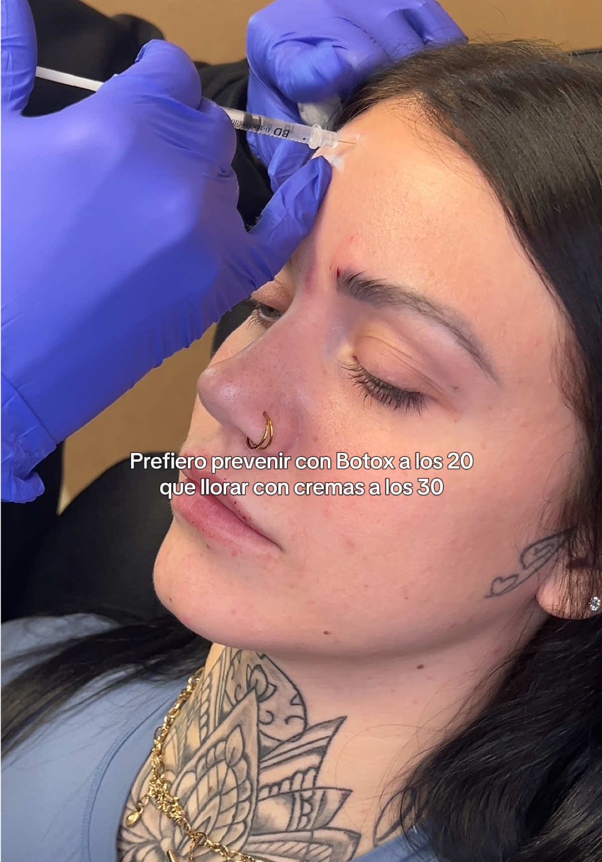 @Vanessa Injects