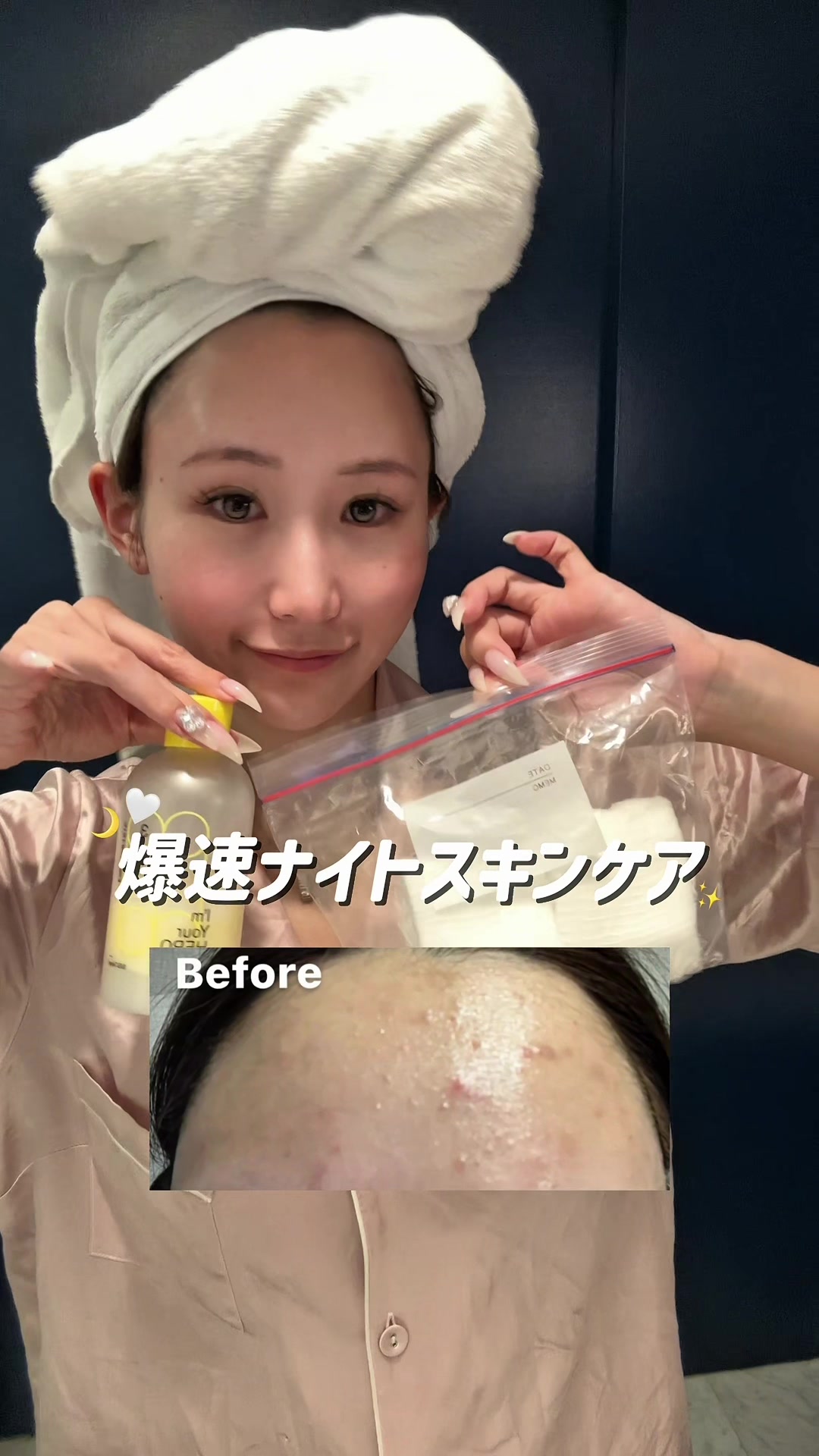 @Nanase