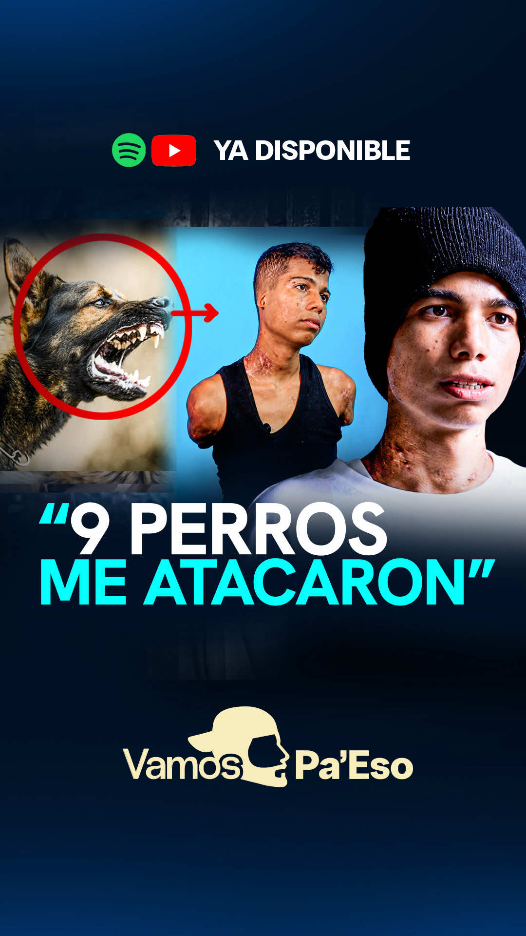 @Vamos pa eso