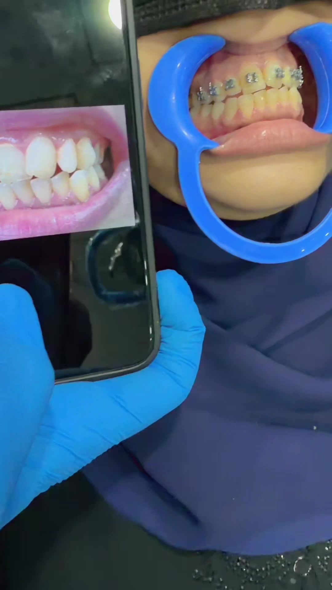 @Dr__Anmoll🦋🦷