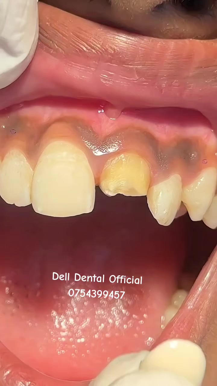 @DellDentalOfficial