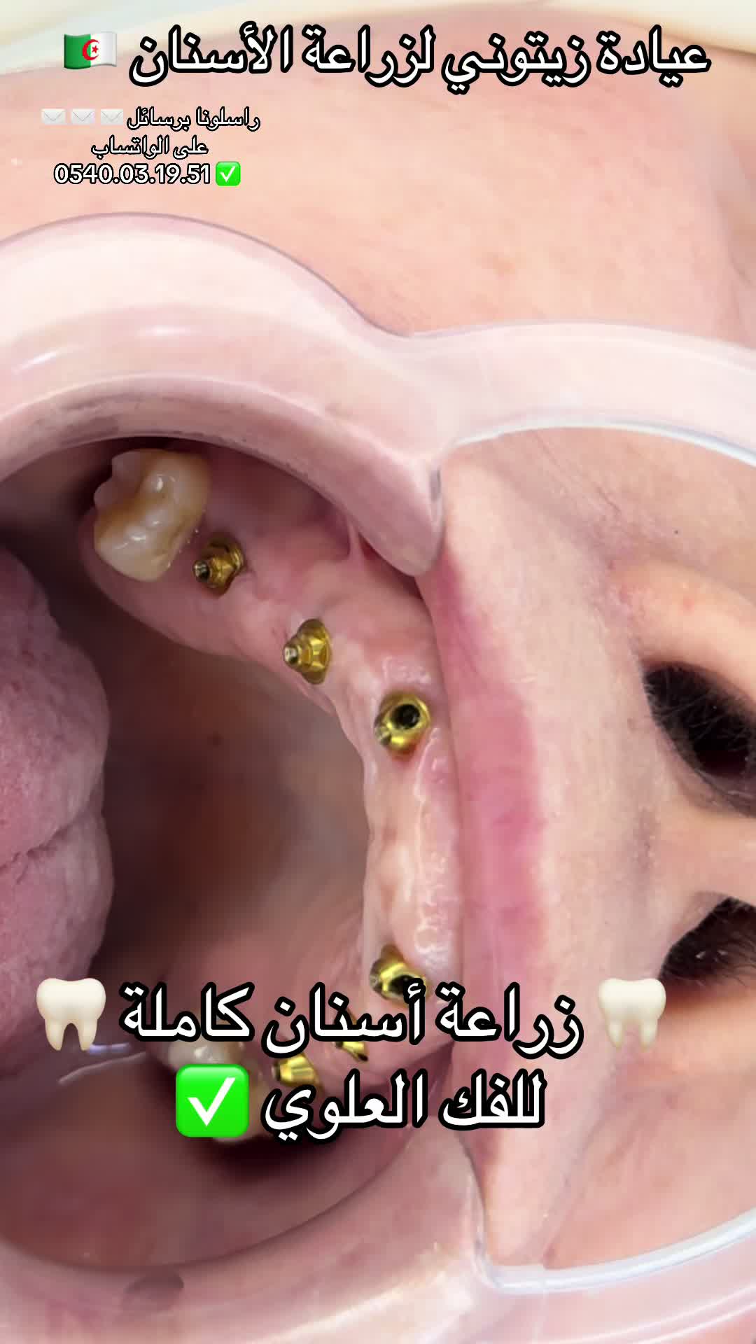 @Docteur Zitouni