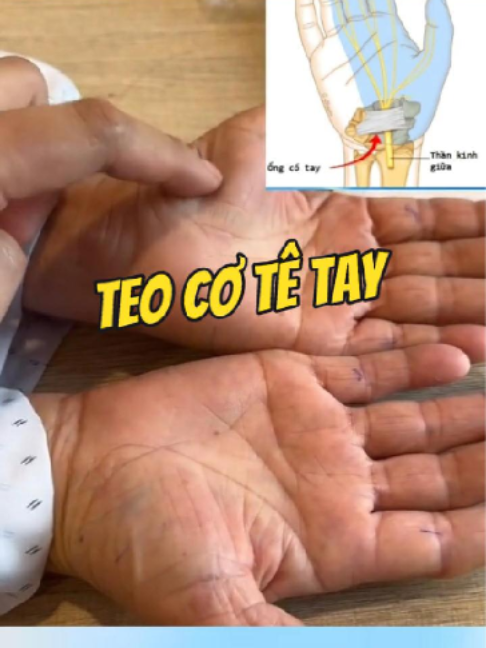 @Chuyên gia xương khớp